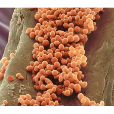 Lactococcus lactis — NATURAMedicatrix