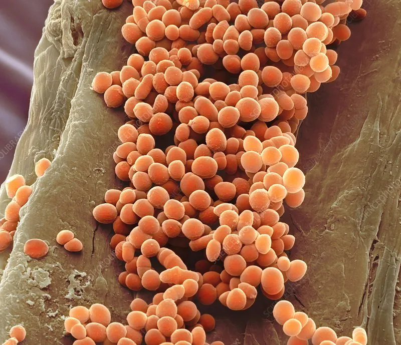 Lactococcus lactis